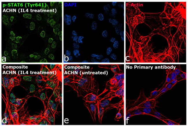 Phospho-Stat6 (Tyr641) Antibody in Immunocytochemistry (ICC/IF)