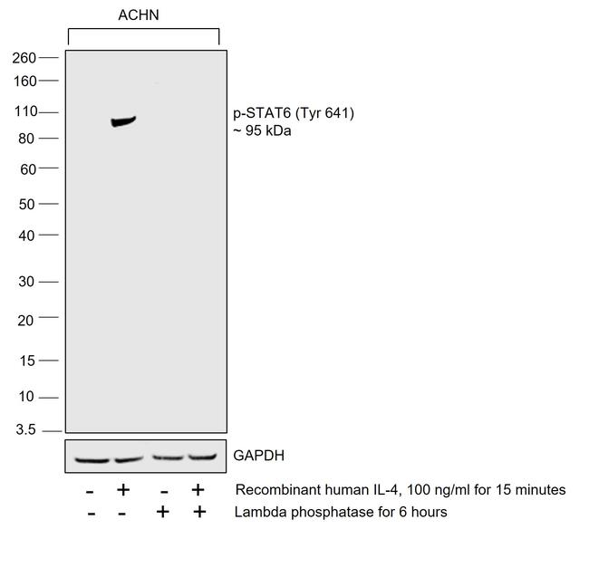 Phospho-Stat6 (Tyr641) Antibody