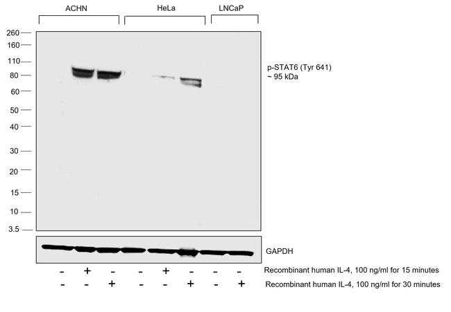 Phospho-Stat6 (Tyr641) Antibody in Western Blot (WB)