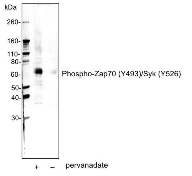 Phospho-ZAP70/Syk (Tyr493, Tyr526) Antibody in Western Blot (WB)