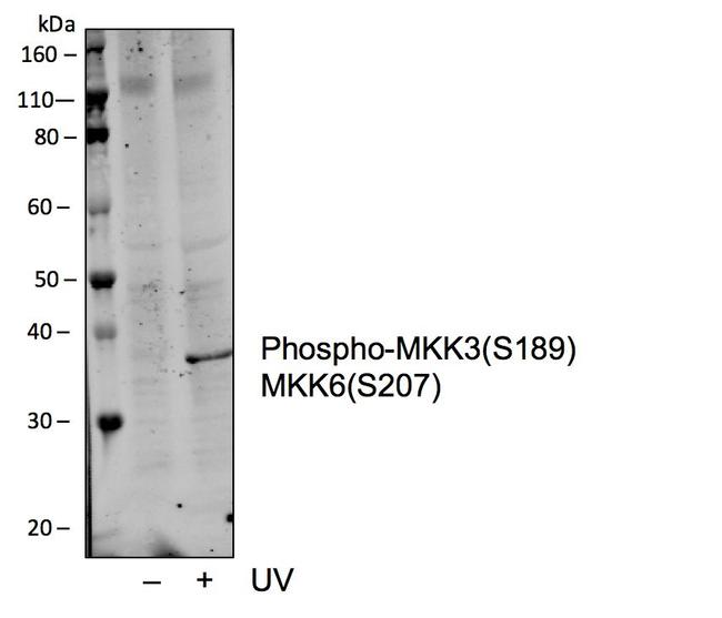 Phospho-MEK3/MEK6 (Ser189, Ser207) Antibody in Western Blot (WB)