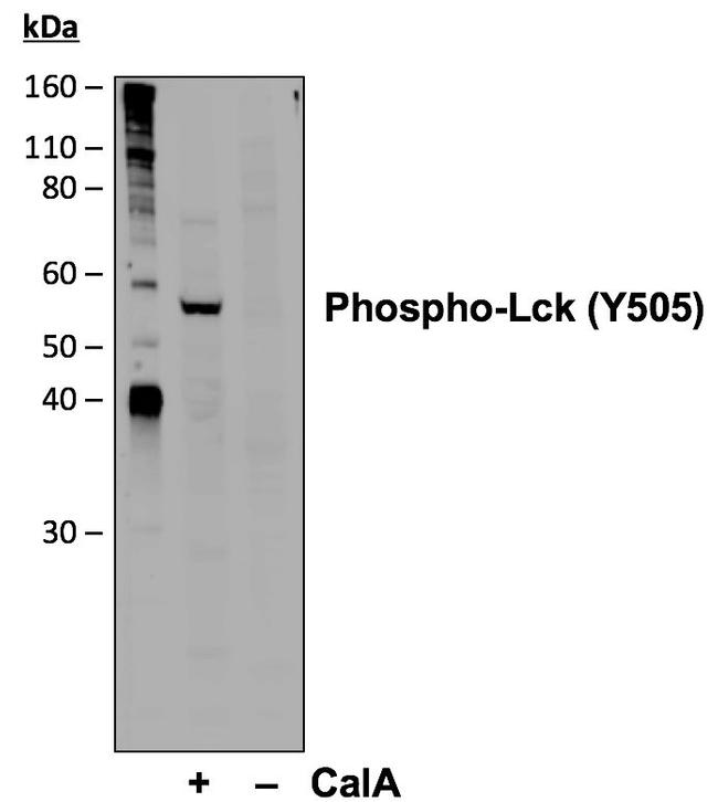 Phospho-Lck (Tyr505) Antibody in Western Blot (WB)