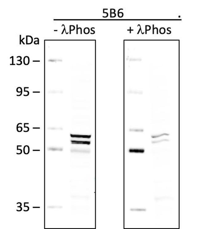 Phospho-Lyn (Tyr507) Antibody in Western Blot (WB)