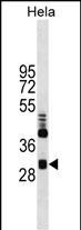 CLIC4 Antibody in Western Blot (WB)