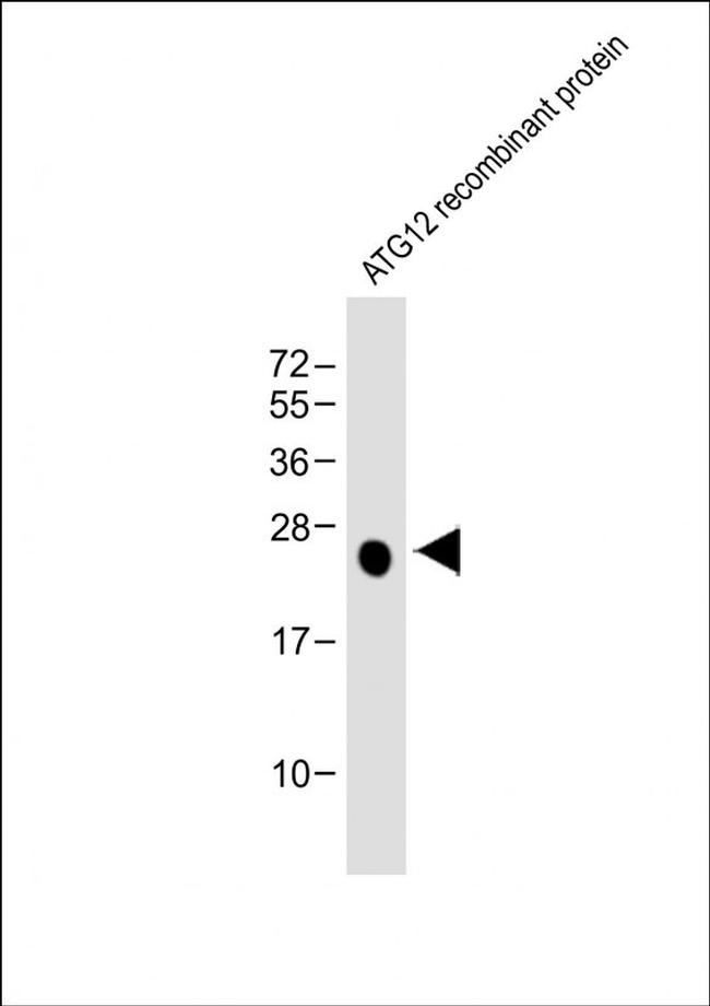 ATG12 Antibody in Western Blot (WB)