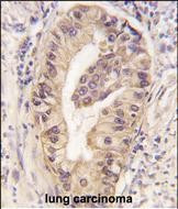 ATG16L1 Antibody in Immunohistochemistry (Paraffin) (IHC (P))