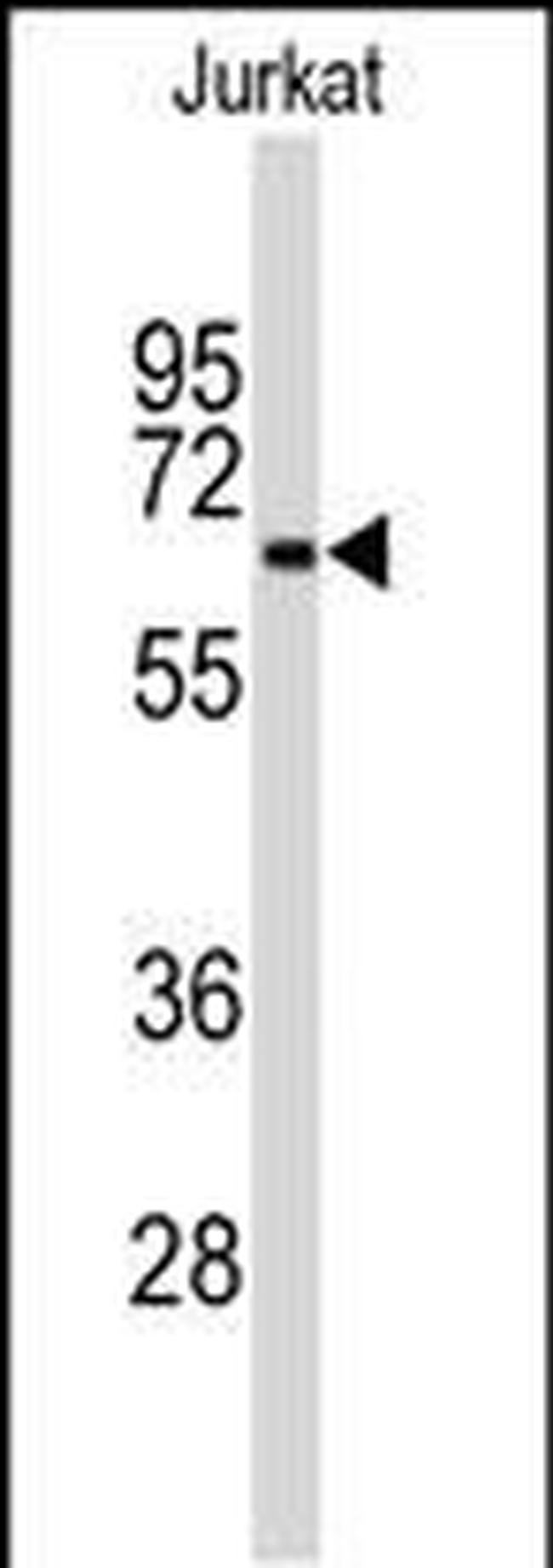 Beclin 1 Antibody in Western Blot (WB)