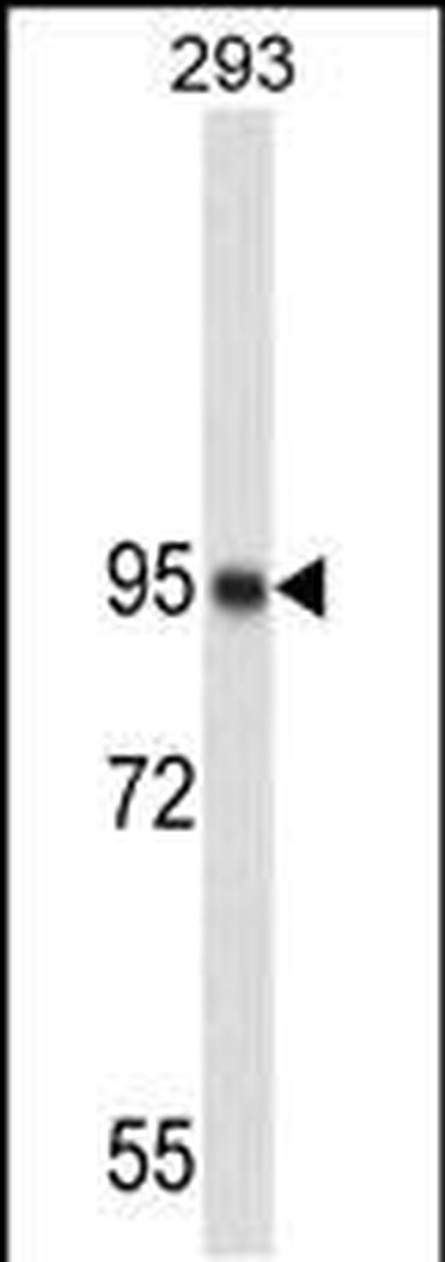 Nucleolin Antibody in Western Blot (WB)