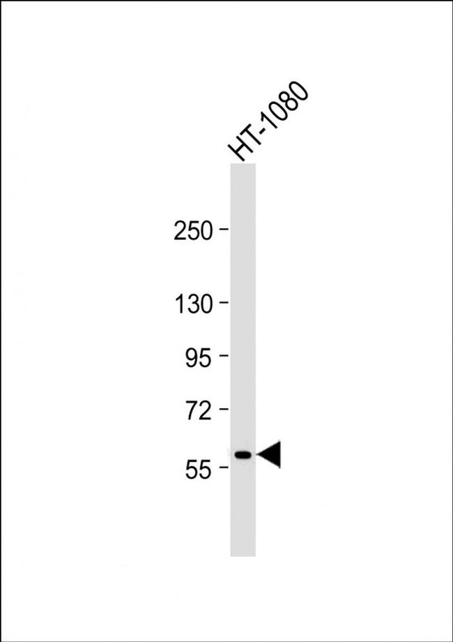 MMP14 Antibody in Western Blot (WB)