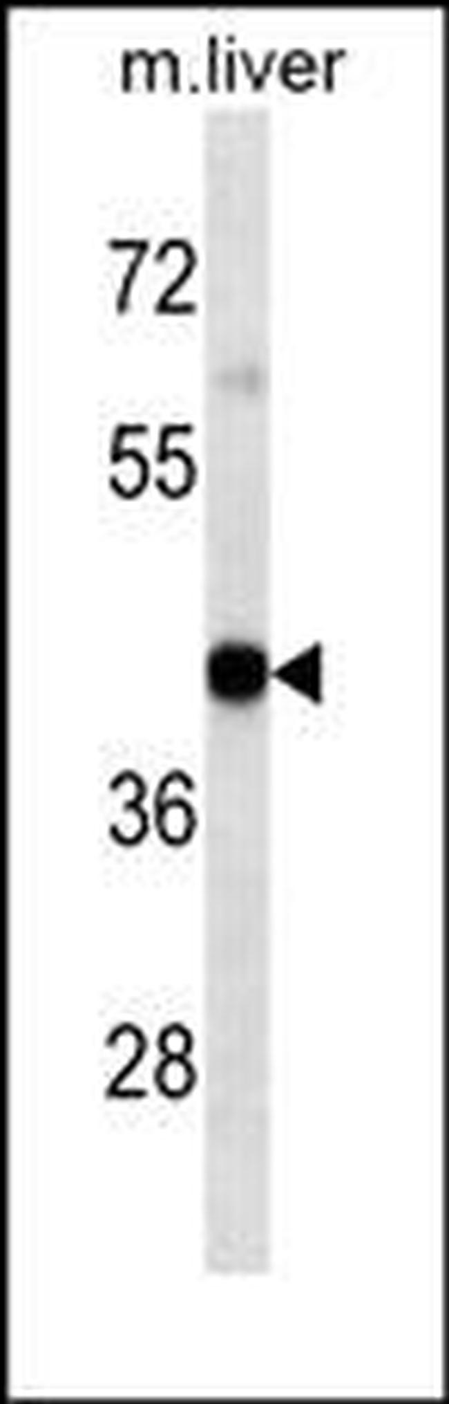 HLA-A Antibody in Western Blot (WB)