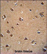 AKT3 Antibody in Immunohistochemistry (Paraffin) (IHC (P))