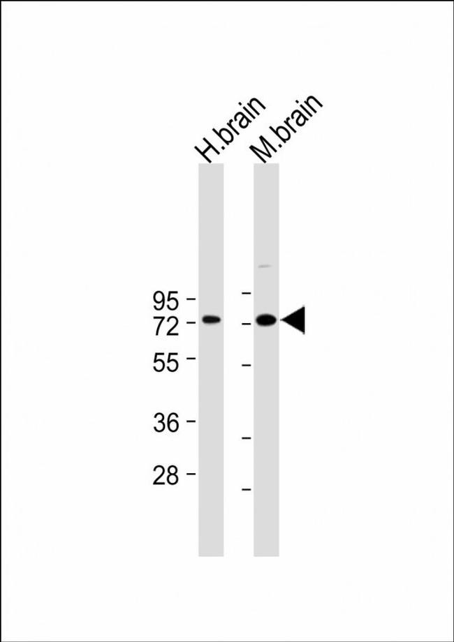 LIMK1 Antibody in Western Blot (WB)