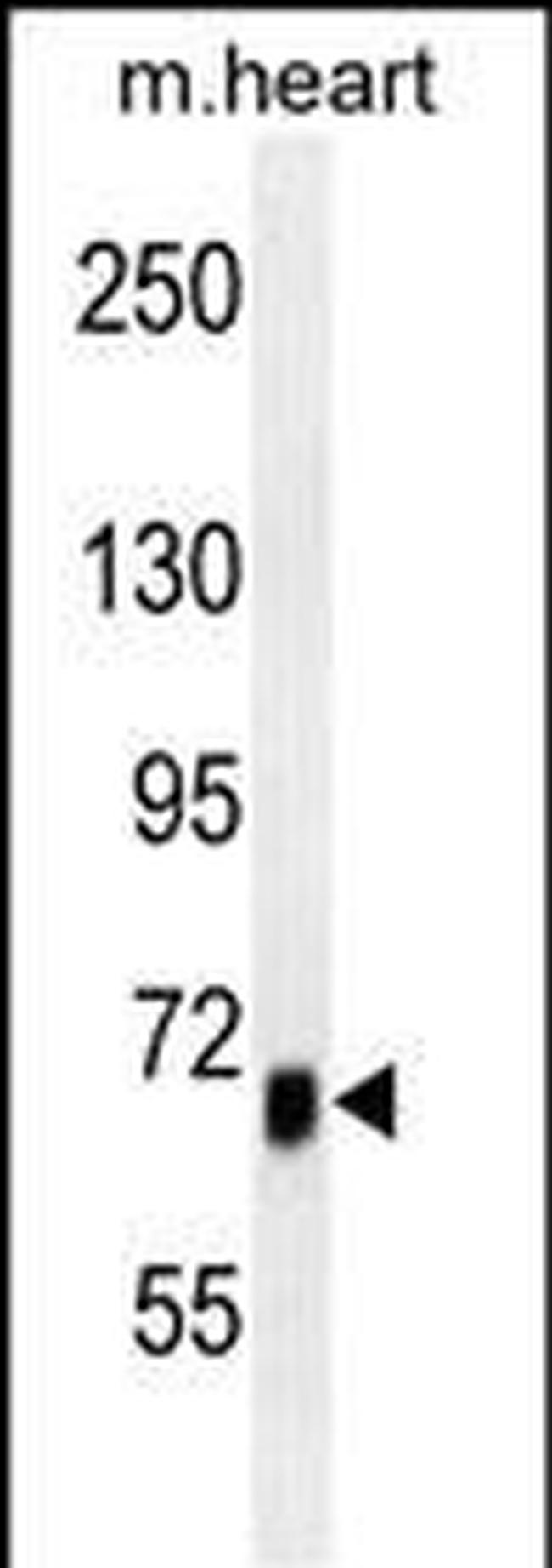 ACVR1B Antibody in Western Blot (WB)