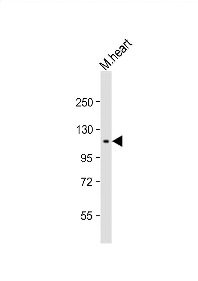 RET Antibody in Western Blot (WB)