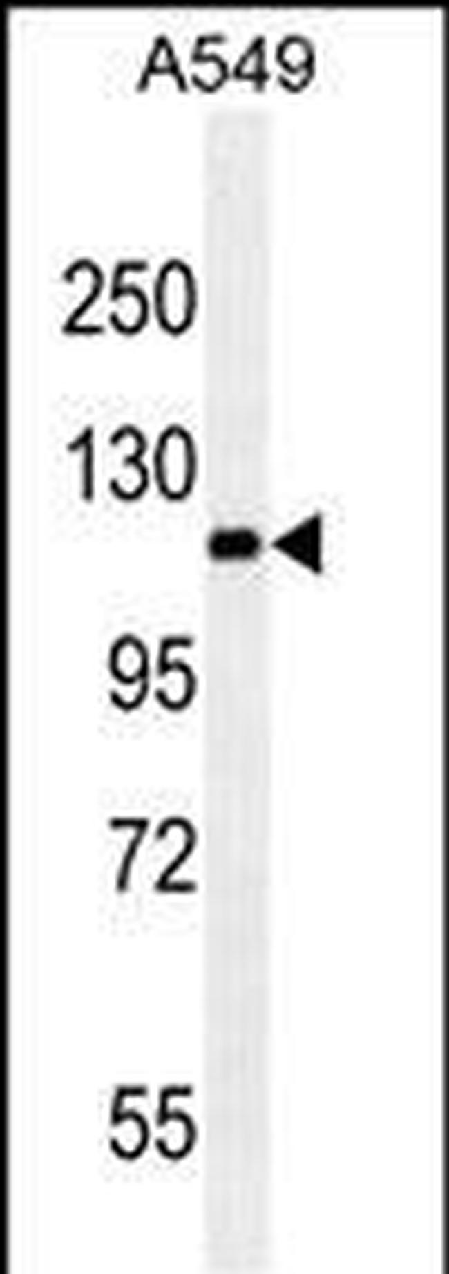 RET Antibody in Western Blot (WB)