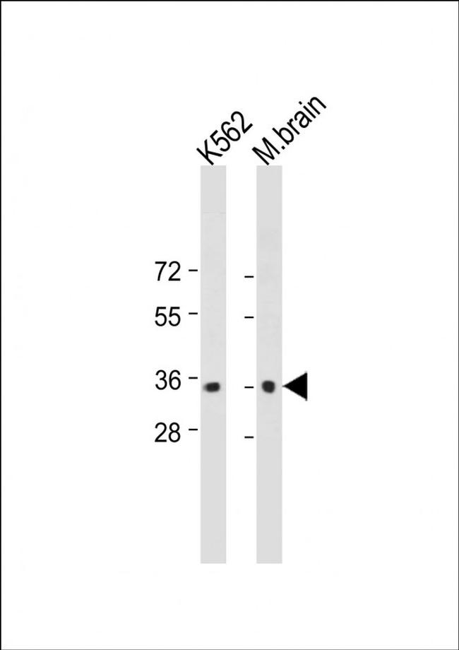 CAB39 Antibody in Western Blot (WB)