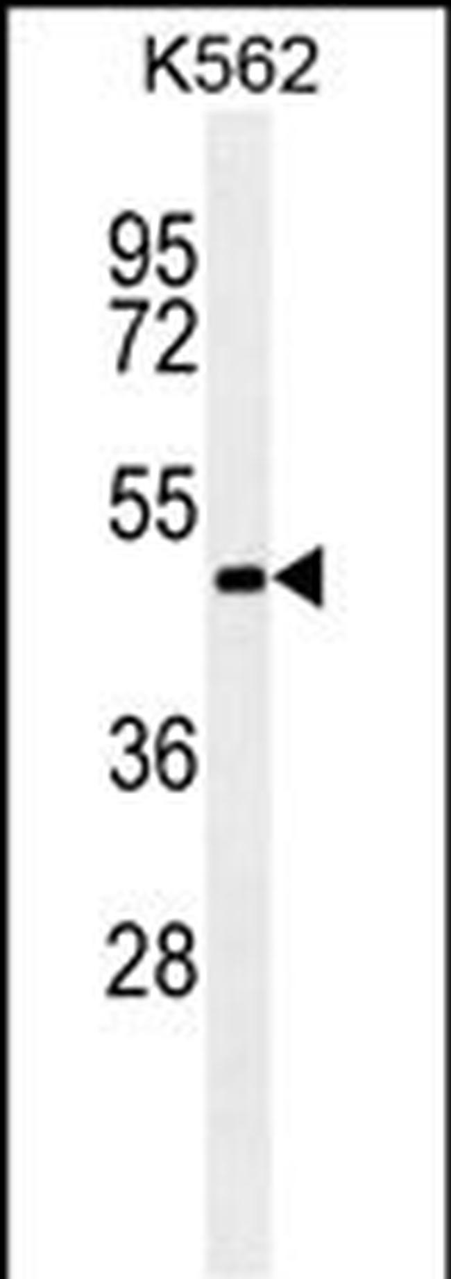 RNF8 Antibody in Western Blot (WB)