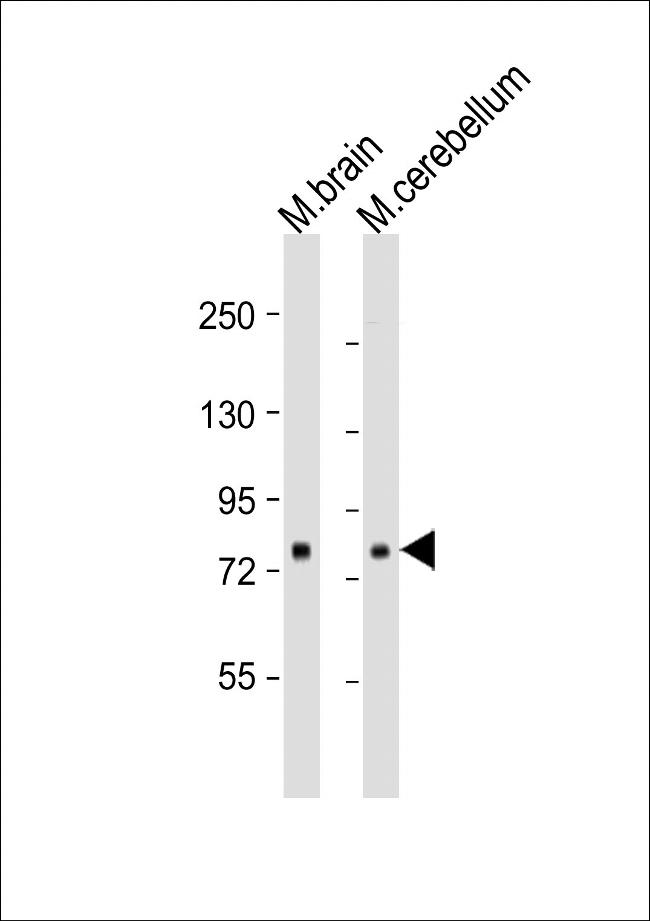 RSK1 Antibody in Western Blot (WB)