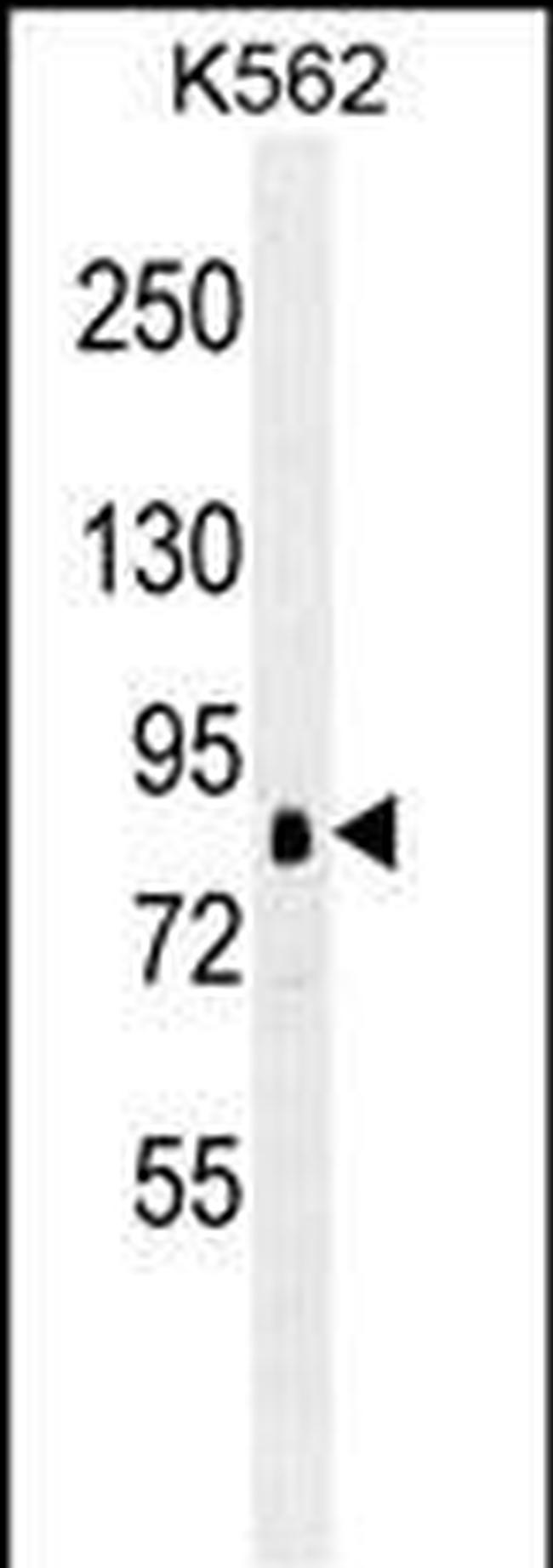 RSK1 Antibody in Western Blot (WB)