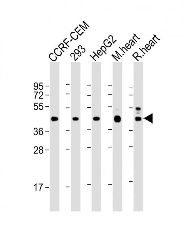 VEGFC Antibody in Western Blot (WB)