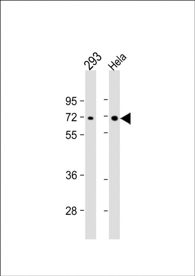 AMPK alpha-2 Antibody in Western Blot (WB)