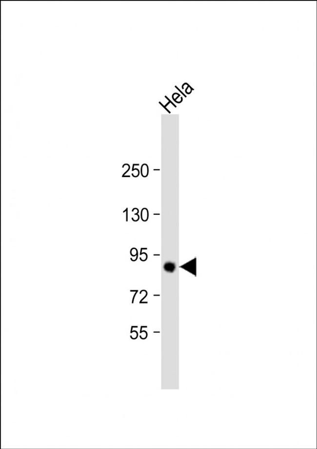 TGM2 Antibody in Western Blot (WB)