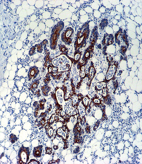 TGF beta-2 Antibody in Immunohistochemistry (Paraffin) (IHC (P))