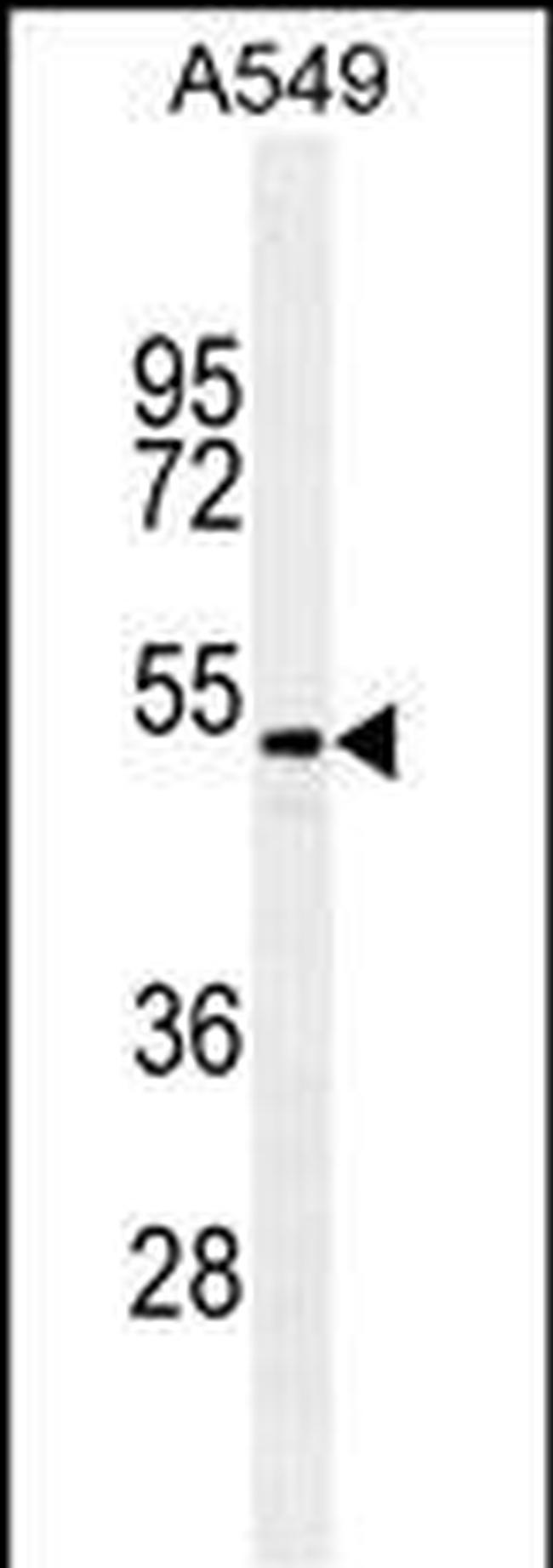 TGF beta-2 Antibody in Western Blot (WB)