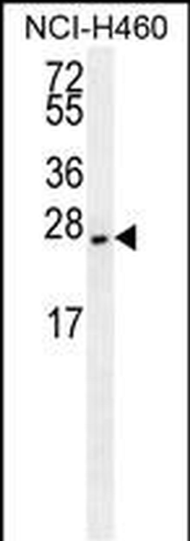 eIF4E2 Antibody in Western Blot (WB)