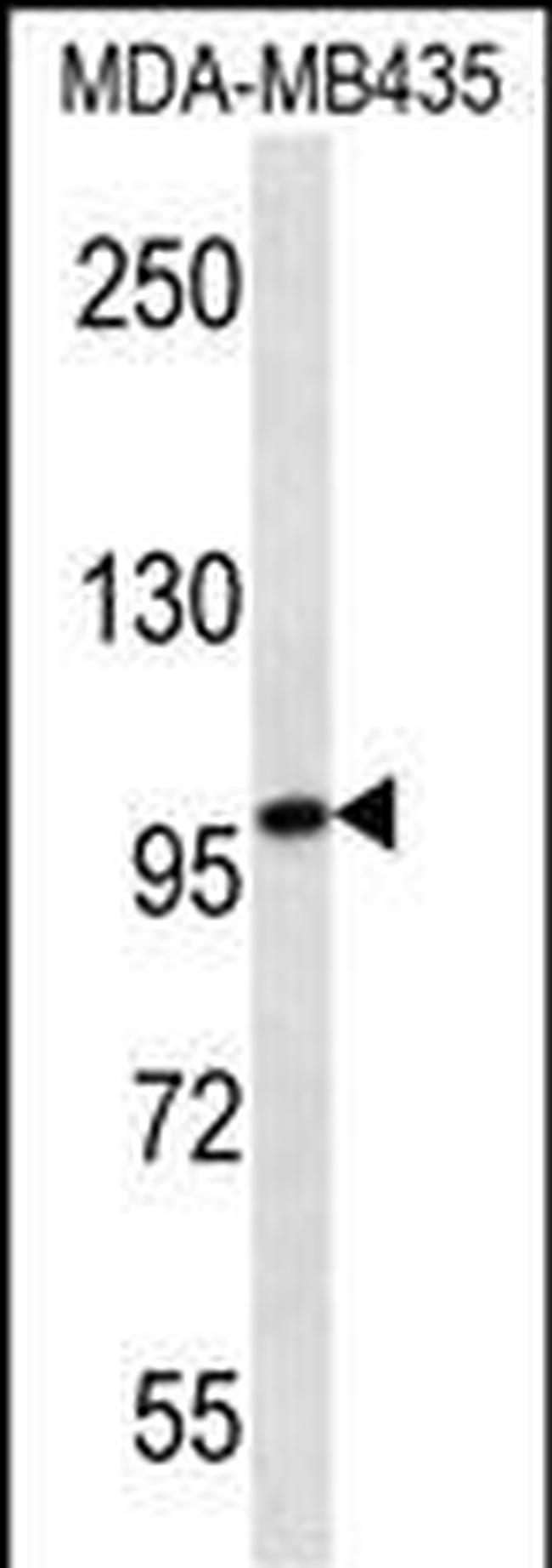 MYO1C Antibody in Western Blot (WB)