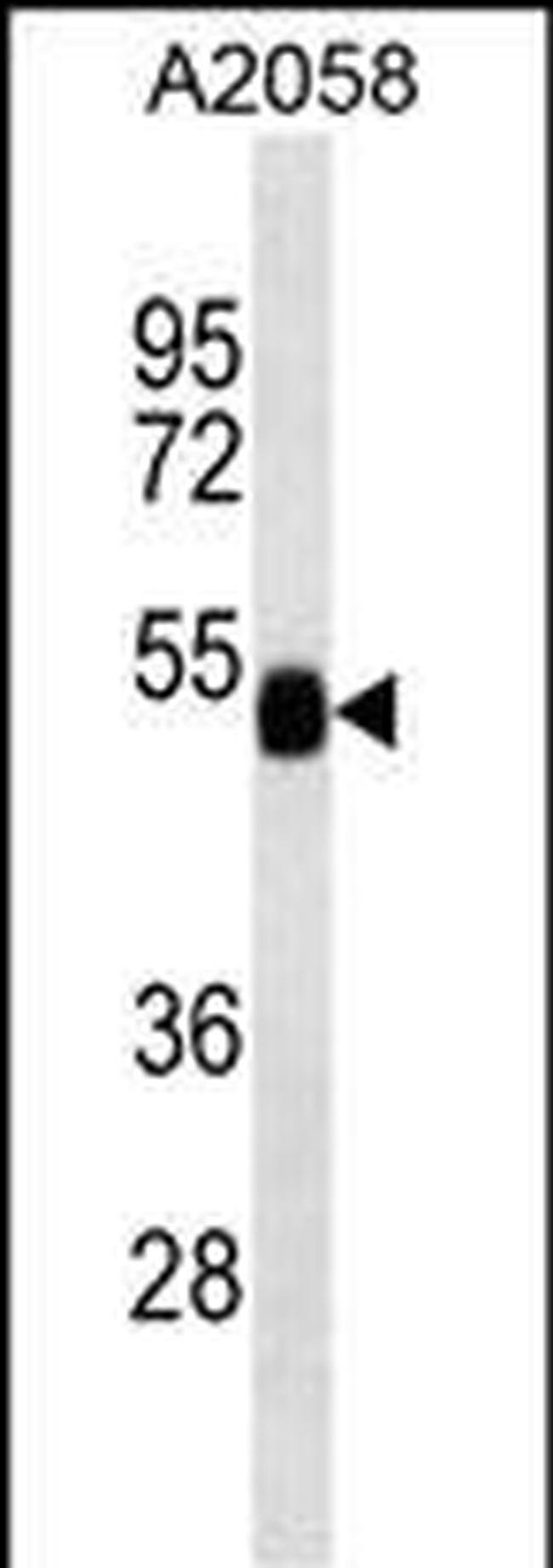 FUCA2 Antibody in Western Blot (WB)