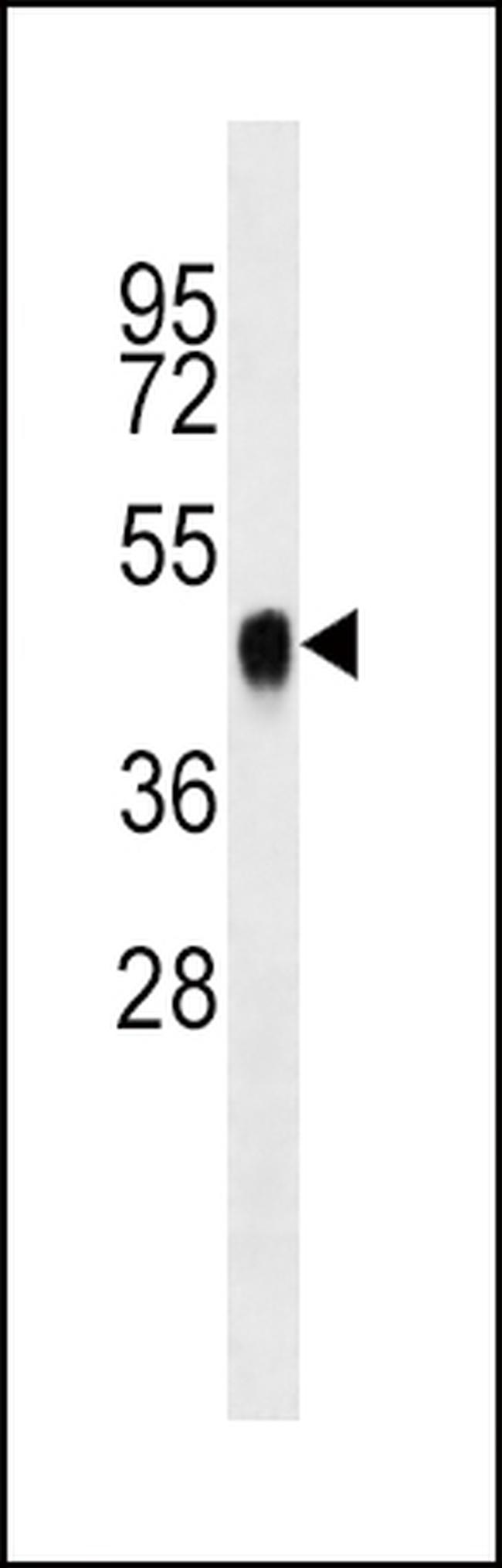 BMI-1 Antibody in Western Blot (WB)