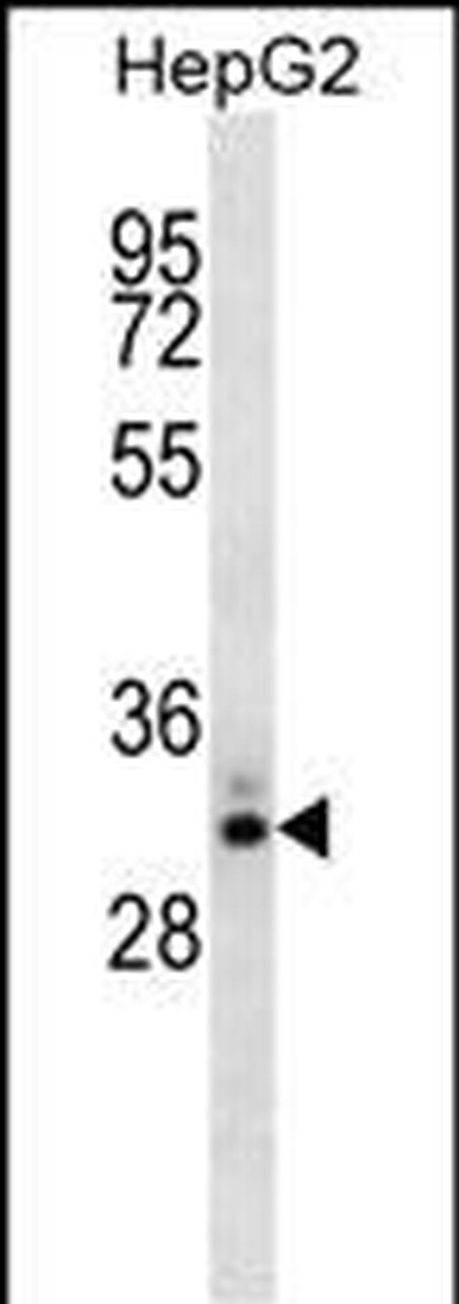 STC2 Antibody in Western Blot (WB)