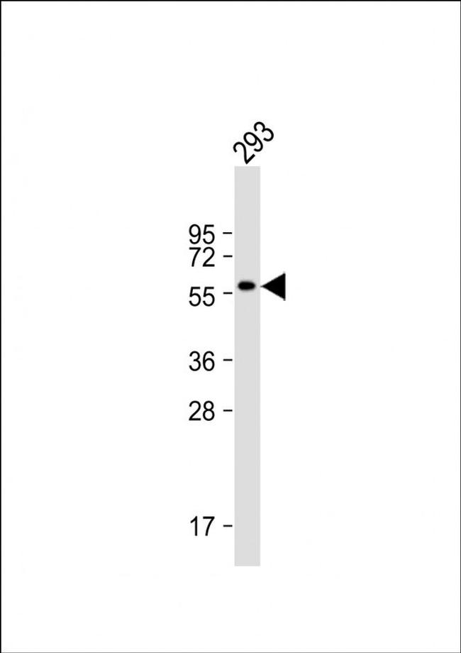 CNOT4 Antibody in Western Blot (WB)