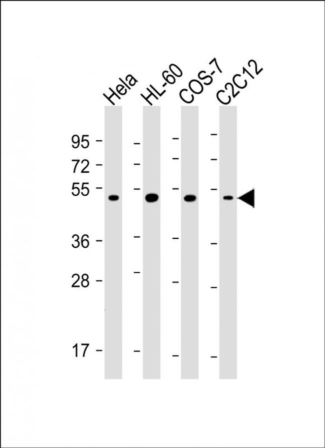 RCC1 Antibody in Western Blot (WB)