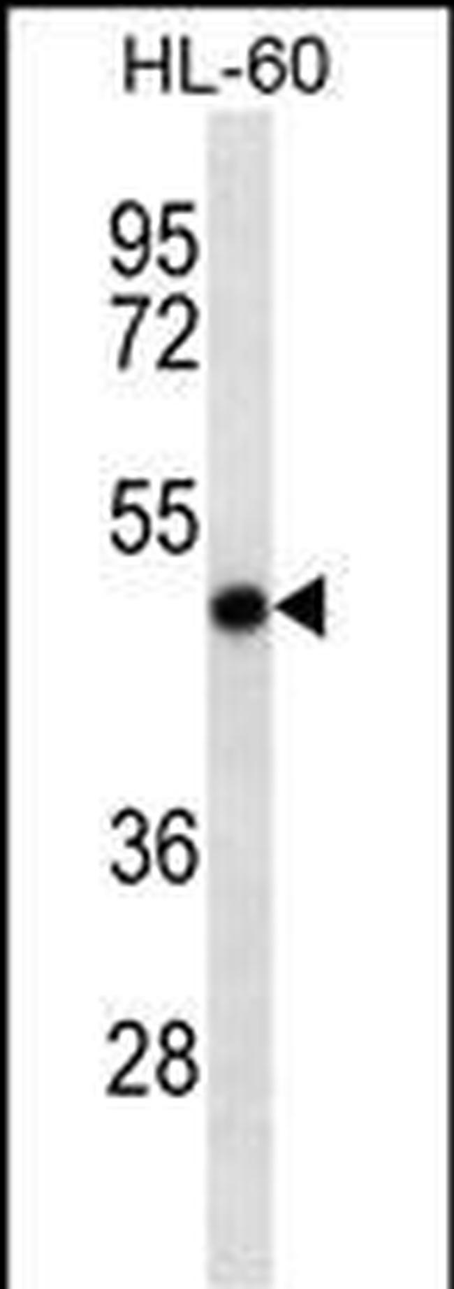 RCC1 Antibody in Western Blot (WB)