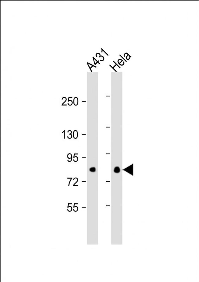 eIF4B Antibody in Western Blot (WB)