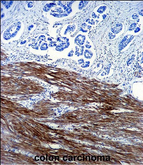 ACTA1 Antibody in Immunohistochemistry (Paraffin) (IHC (P))