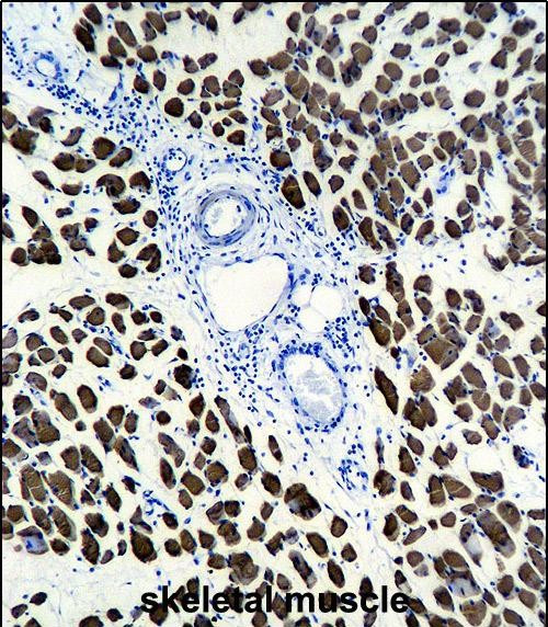 ACTA1 Antibody in Immunohistochemistry (Paraffin) (IHC (P))