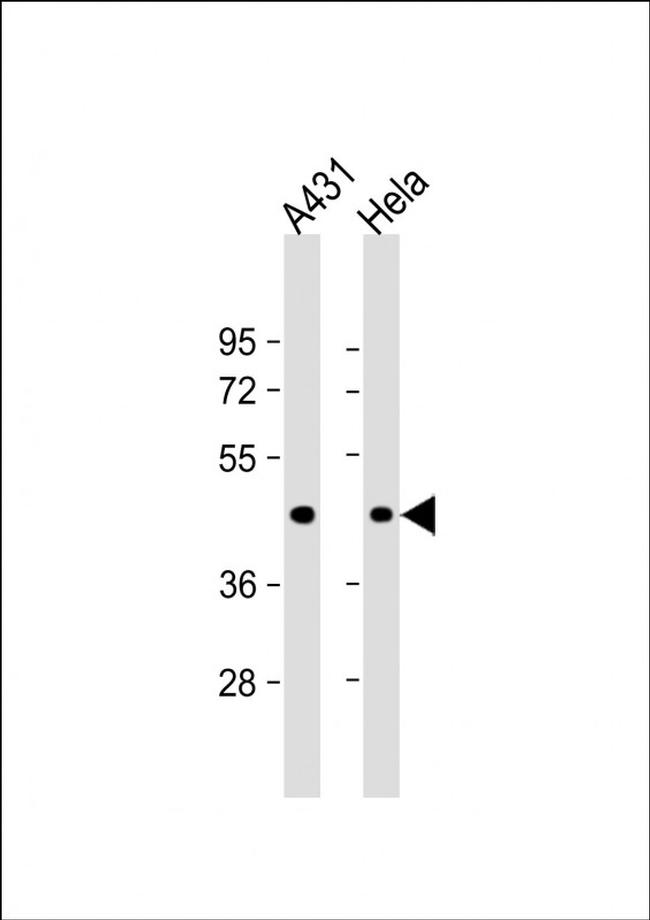 ACTA1 Antibody in Western Blot (WB)