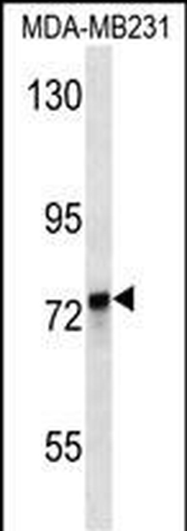 KEAP1 Antibody in Western Blot (WB)