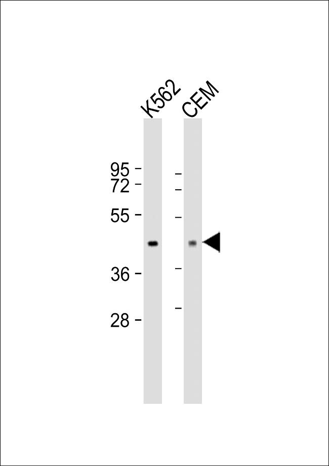 PDK4 Antibody in Western Blot (WB)