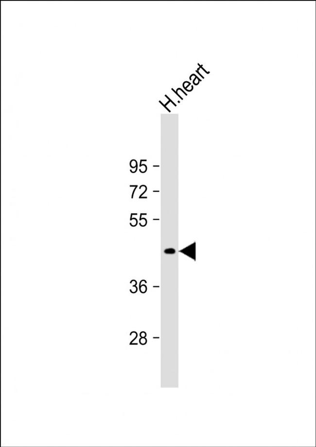 PDK4 Antibody in Western Blot (WB)