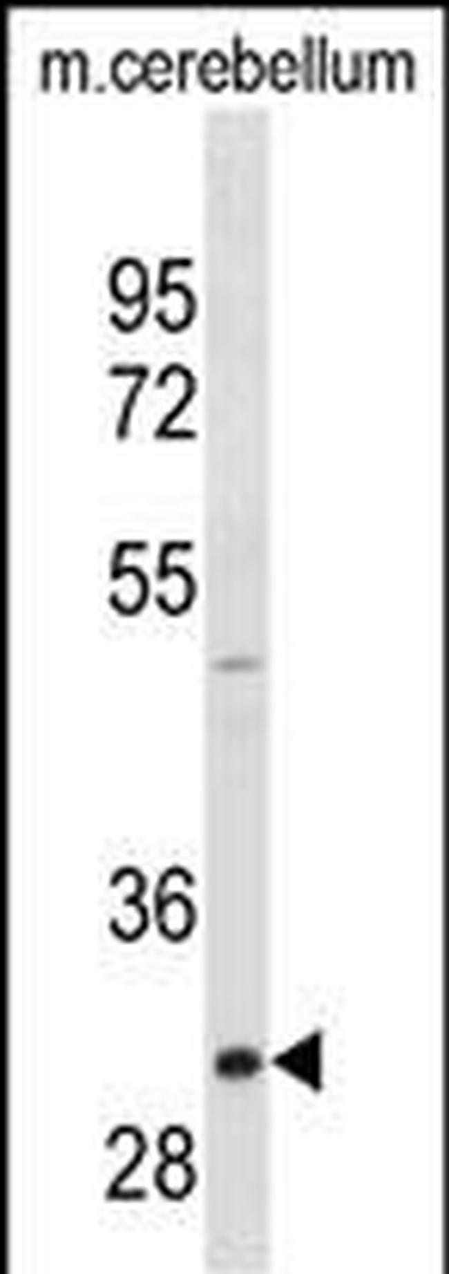 ZWINT Antibody in Western Blot (WB)