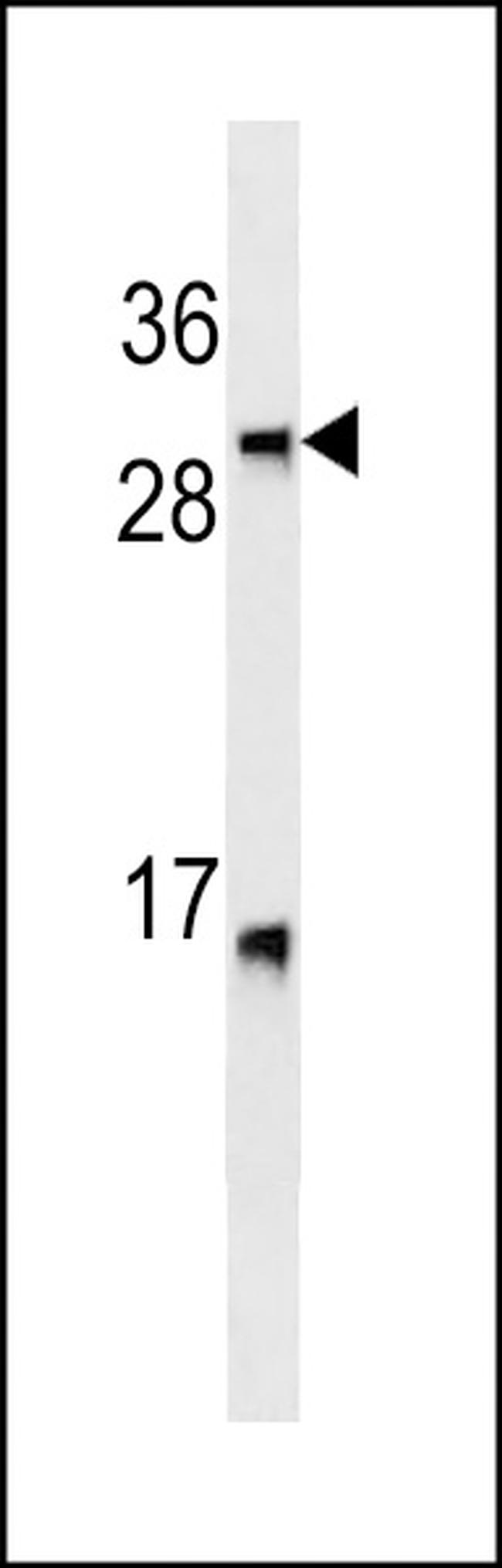 LTB Antibody in Western Blot (WB)