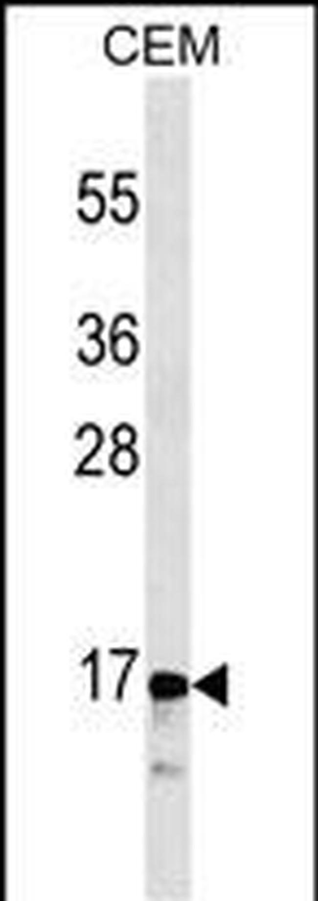 Calcitonin Antibody in Western Blot (WB)