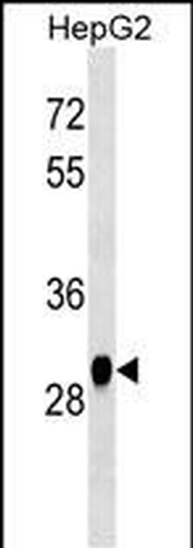 HNMT Antibody in Western Blot (WB)