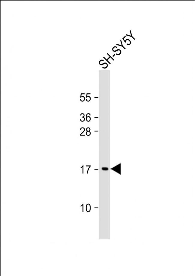 GABARAP Antibody in Western Blot (WB)