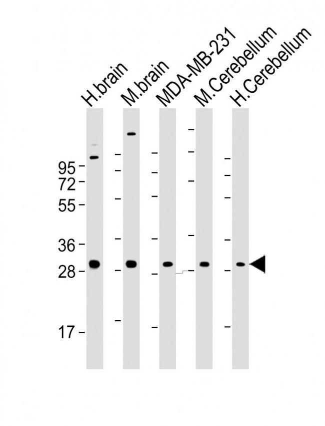 RAB23 Antibody in Western Blot (WB)