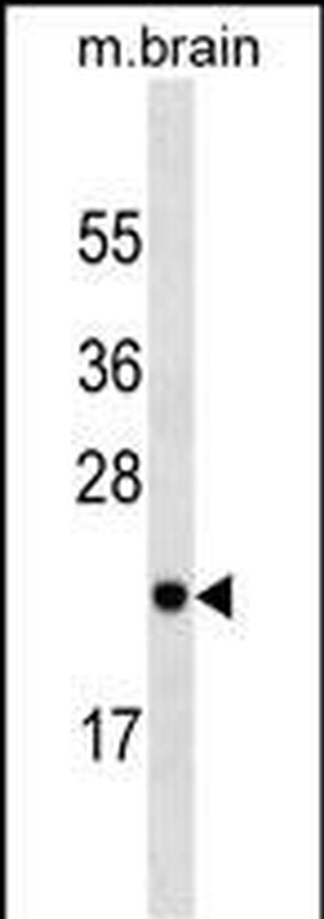 RAB23 Antibody in Western Blot (WB)